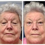 PRO-XO™ Topical Exosome Serum