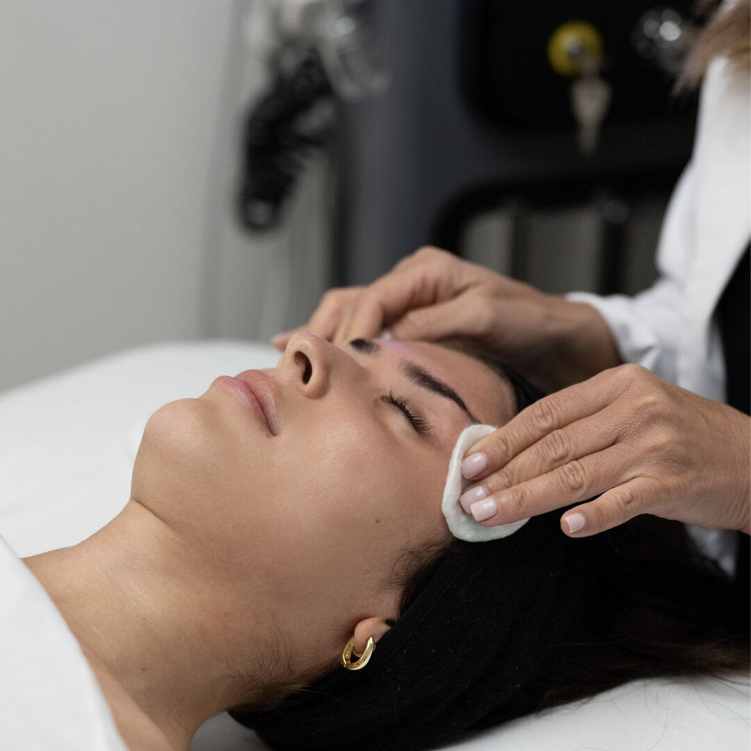 The Ultimate Guide to VI Peel: The Best Chemical Peel for Glowing, Rejuvenated Skin