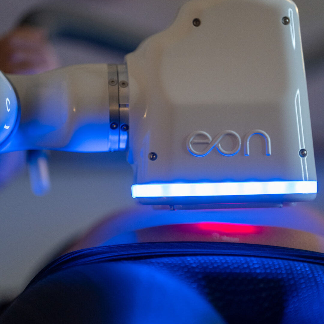 EON: The Most Advanced Non-Invasive Body Contouring Solution at NDA Medical Spa