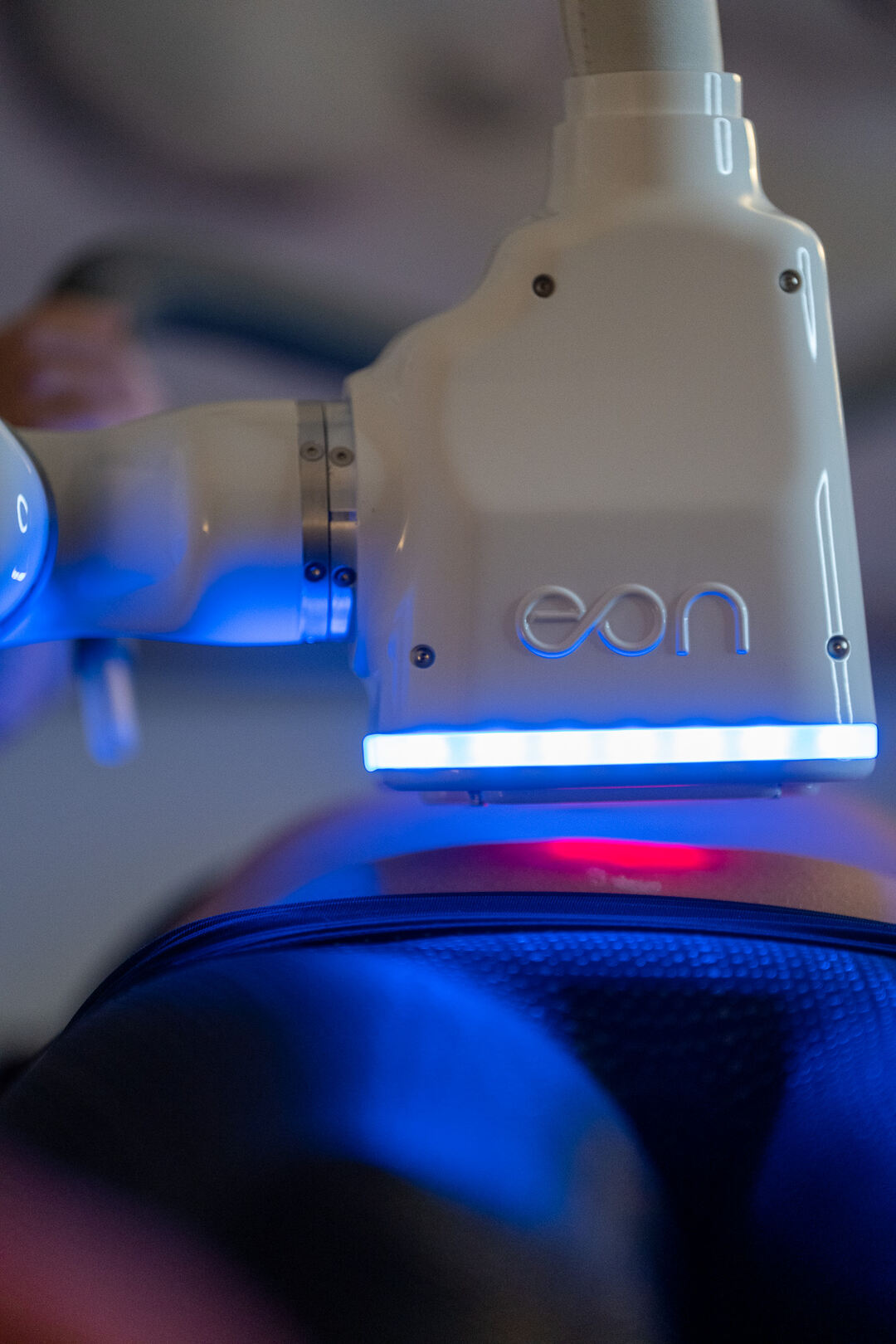 EON: The Most Advanced Non-Invasive Body Contouring Solution at NDA Medical Spa