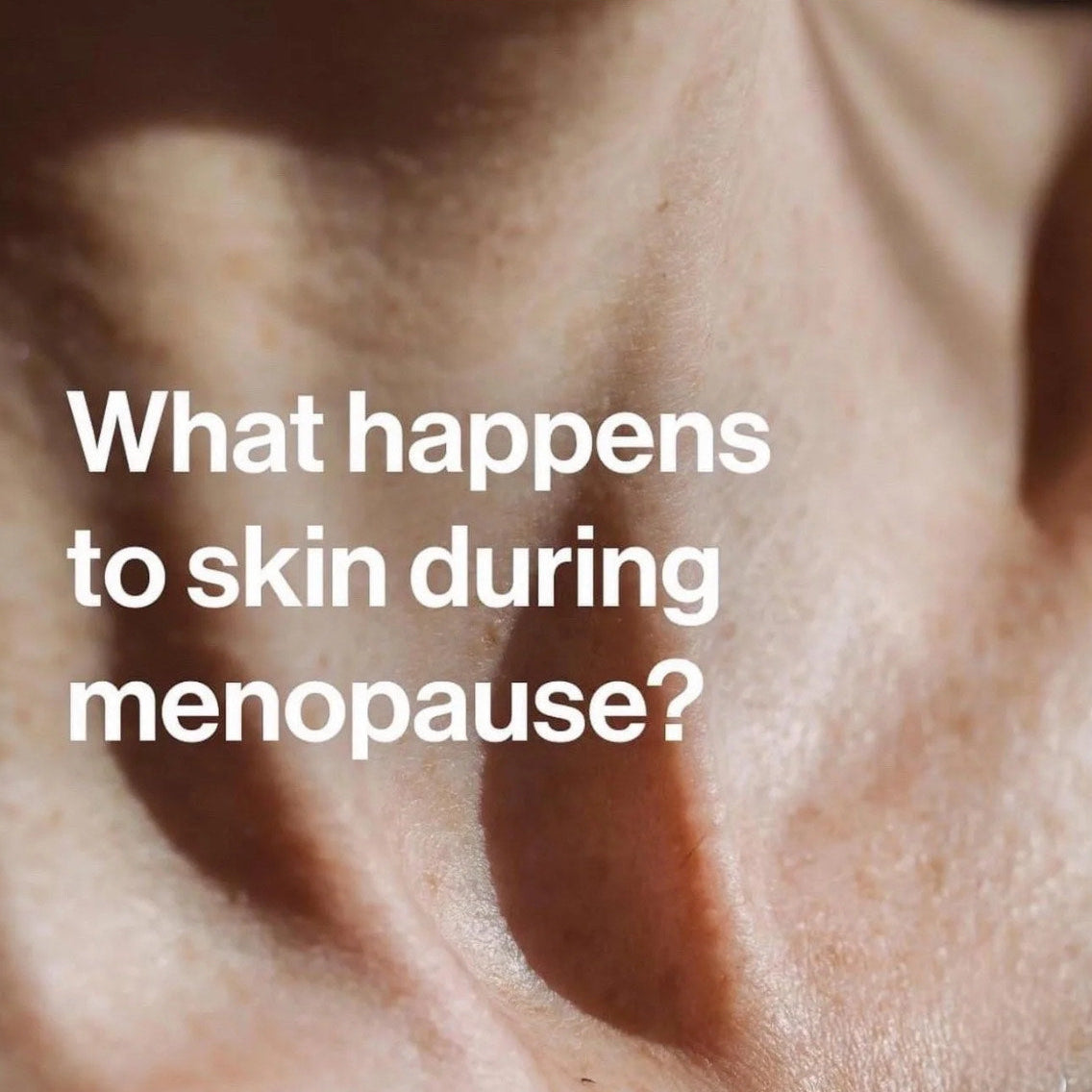 What Happens to Your Skin During Menopause