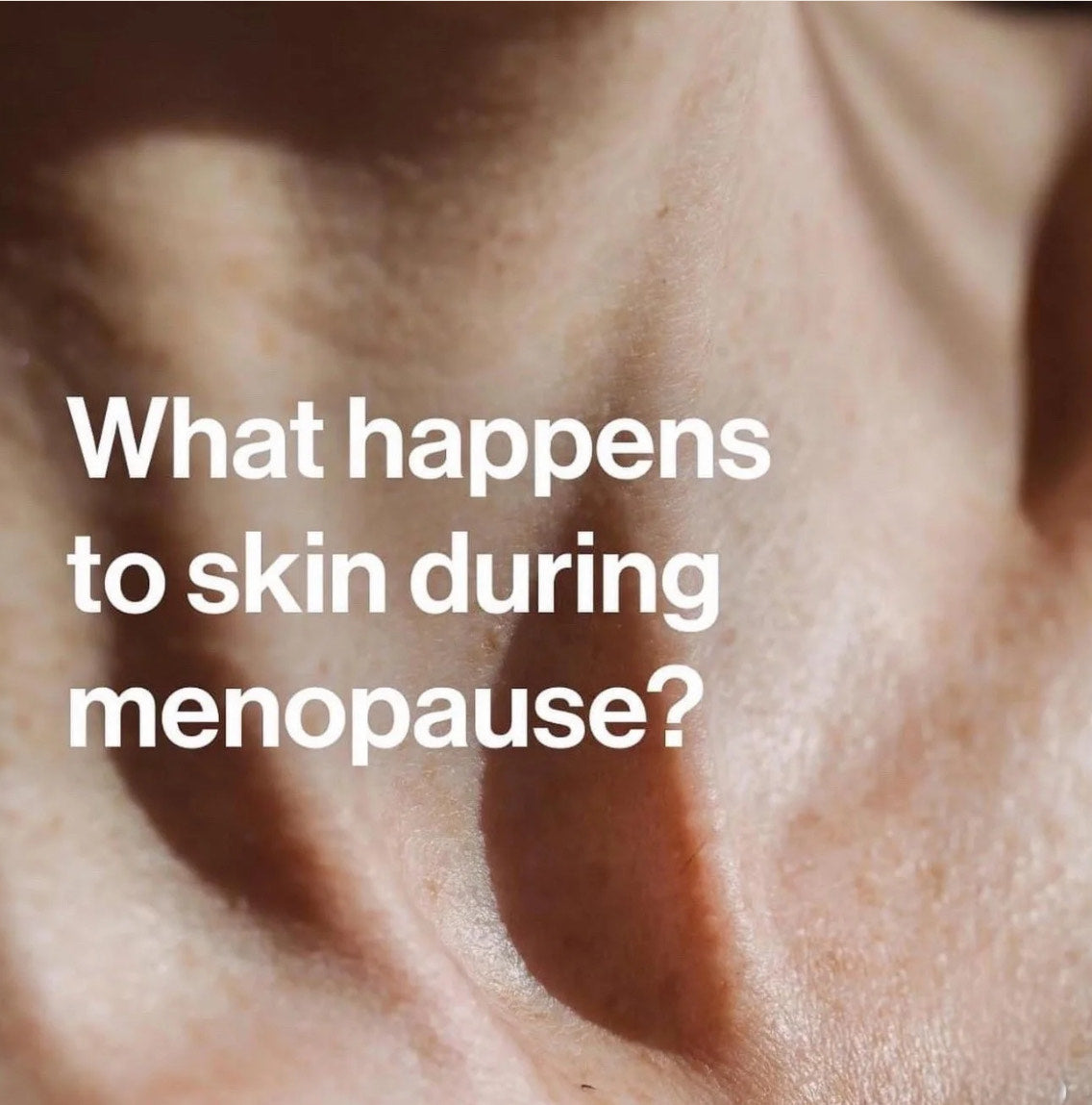 What Happens to Your Skin During Menopause