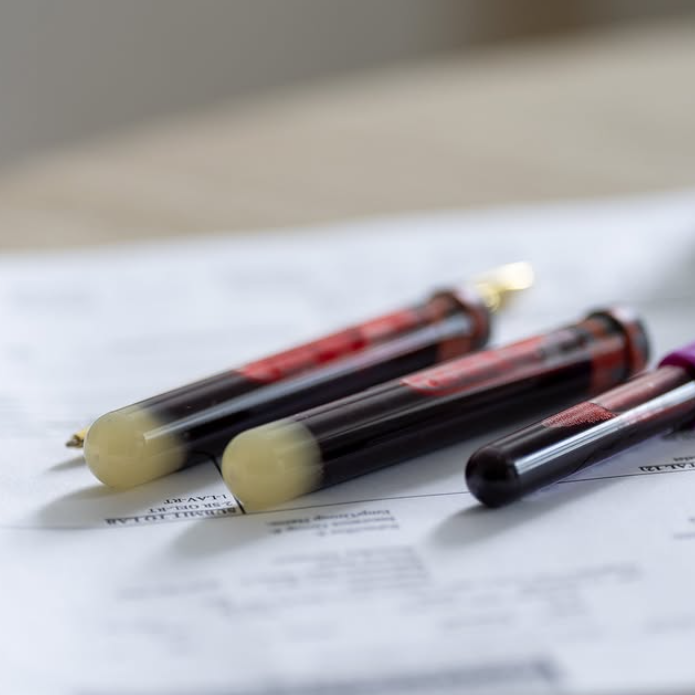 The Benefits of PRP for Hair Restoration: A Comprehensive Guide